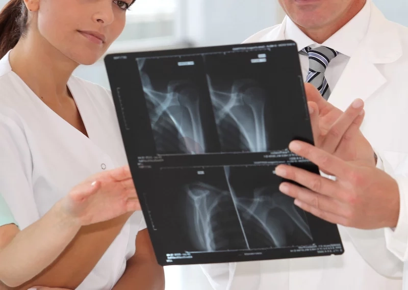 diagnose-broken-bones